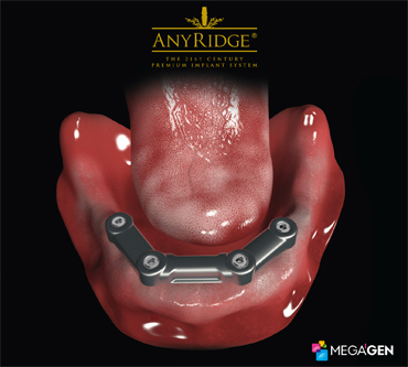 Image 4. Failing dentition  due to gum disease