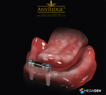 Image 4. Failing dentition  due to gum disease