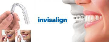 Invisalign